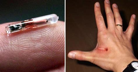 human rfid chips won t be optional|bionic chips for humans.